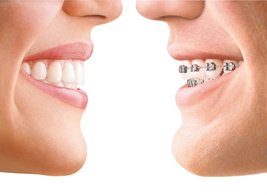 talsmand venstre skrige How Often Should you Brush your Teeth? | Family Dentistry of Harrisburg